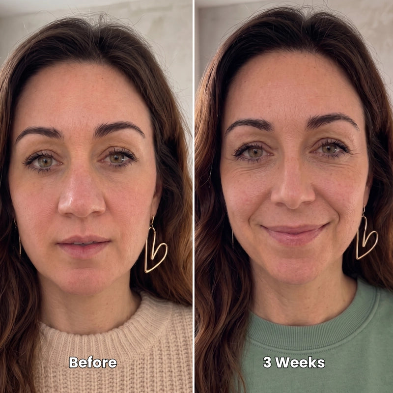 Priya S. before and after using Ozlura